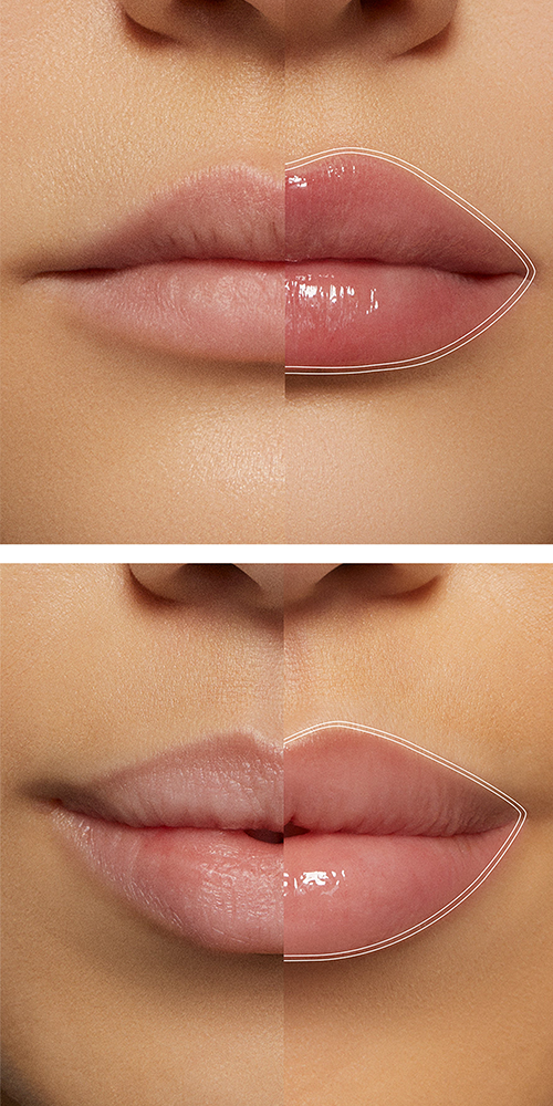 Mini Plump Shot™ Peptides Lip Serum