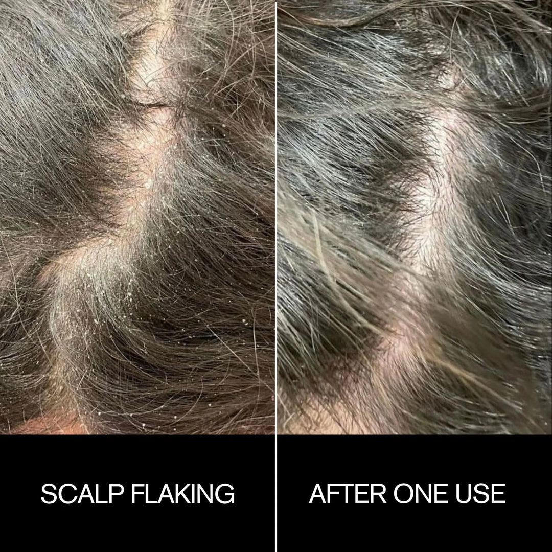 Sunday Scalp Mask
