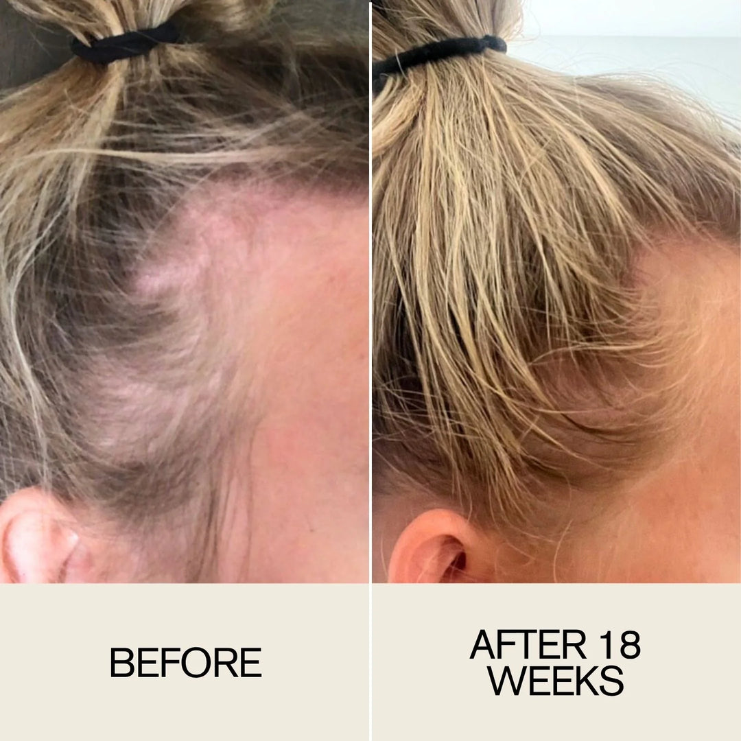 Follicle Drops