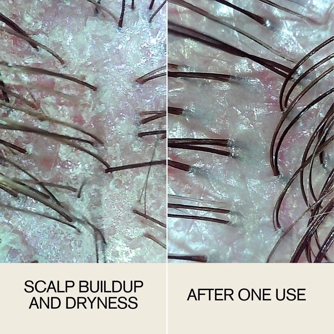 Follicle Drops